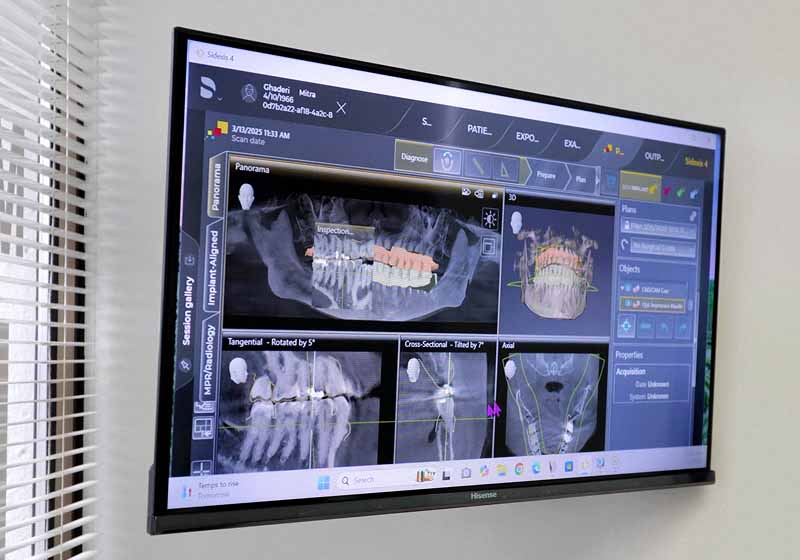 digital tools used to view oral X-rays